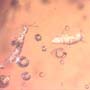 Rare Fungus Gnat With Twenty Eggs, Spider And Four Elongate Springtail In Dominican Amber.