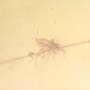 Rare Gall Midge Clinging On A Leg Of A Bug In Dominican Amber.