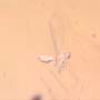 Rare One Egg And Jumping Plant Lice In Dominican Amber