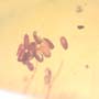 Rare Twelve Eggs In Dominican Amber
