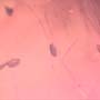 Rare Thirteen Eggs In Dominican Amber