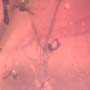 Rare Thirteen Eggs In Dominican Amber