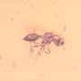 Rare Two Eggs And Scelionid Wasp In Dominican Amber