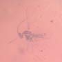 Rare Almost Mating Midge And Two Gall Midges In Dominican Amber.