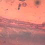Rare Bunch Of Eggs In Dominican Amber