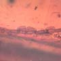 Rare Bunch Of Eggs In Dominican Amber