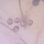 Rare Caddisfly With Bunch Of Eggs In Dominican Amber