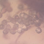 Rare Caddisfly With Bunch Of Eggs In Dominican Amber