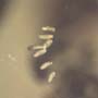 Rare Decomposed Gall Midge With Seven Eggs In Dominican Amber.