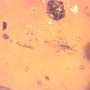 Rare Gall Midge With Two Eggs In Dominican Amber.