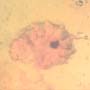 Rare Isopod In Dominican Amber