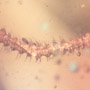 Rare Millipede And Three Eggs In Dominican Amber.