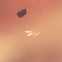 Rare Millipede And Three Eggs In Dominican Amber.