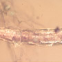 Rare Millipede And Five Eggs In Dominican Amber.