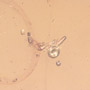 Rare Millipede And Five Eggs In Dominican Amber.