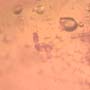 Rare Larval Case Of Tineid Moth In Dominican Amber