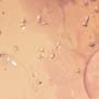 Rare Possible Baby Tick And Male Ant In Dominican Amber