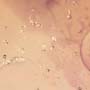 Rare Possible Baby Tick And Male Ant In Dominican Amber