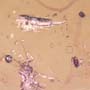 Rare Possible Baby Tick And Male Ant In Dominican Amber