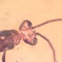 Rare Possible Baby Tick And Male Ant In Dominican Amber