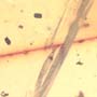 Rare Pseudoscorpion And Mammal Hair In Dominican Amber