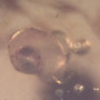 Rare Reptile Skin And Snail In Dominican Amber