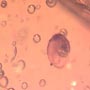 Rare Snail In Dominican Amber
