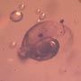 Rare Snail In Dominican Amber