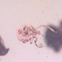 Rare Tick In Dominican Amber