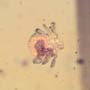 Rare Tick In Dominican Amber