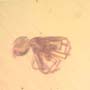Rare Whip Scorpion In Dominican Amber