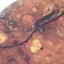 Rare Jumping Plant Lice And Two Flower Stamen In Dominican Amber
