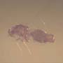 Rare Jumping Plant Lice And Barklouse In Dominican Amber