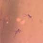 Rare Larva Of Branchypsectidae, Spider, Sphead Wasp, Mite And Two Fairy Fly In Dominican Amber.