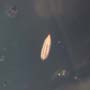 Rare Larvae With Eggs, Small Swarm Elongate Springtail And Pomace Fly With Eggs In Dominican Amber