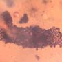 Rare Larval Case Of Tineid Moth In Dominican Amber.