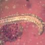 Rare Larval Case Of Tineid Moth And Two Millipedes In Dominican Amber.