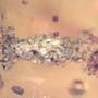 Rare Larval Case Of Tineid Moth And Opening Seed In Dominican Amber.