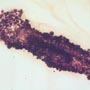 Rare Larval Case Of Tineid Moth And Thrip In Dominican Amber.